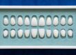 teeth whitening cost los angeles