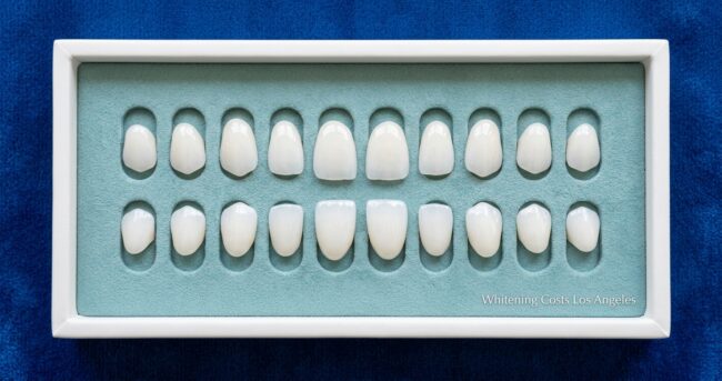 Whitening Cost Los Angeles 2026 teeth whitening cost los angeles