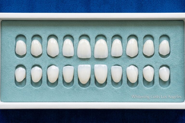 teeth whitening cost los angeles