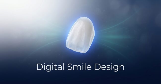 digital smile design